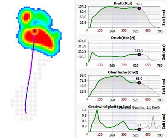 Footchecker Fußanalyse